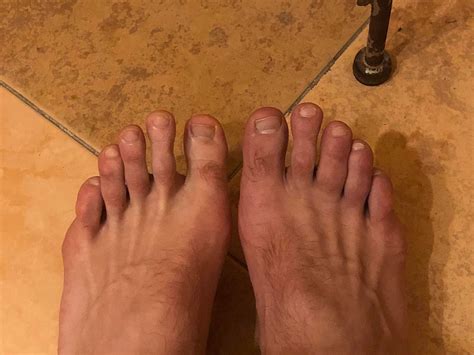 middle toe pain askdocs