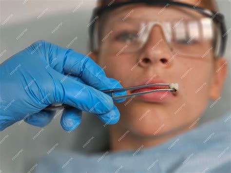 Premium Photo | Dentist holds extracted tooth with caries with forceps