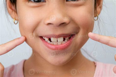 Close-up of cute young girl smiling wide, showing empty space with ...