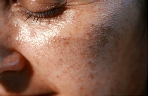 environmental factors  skin health  dermatology partners