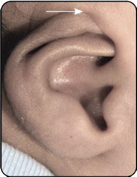 products meditec devices