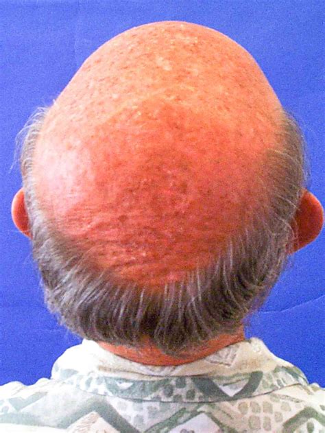 seeing scalp when hair is wet 2