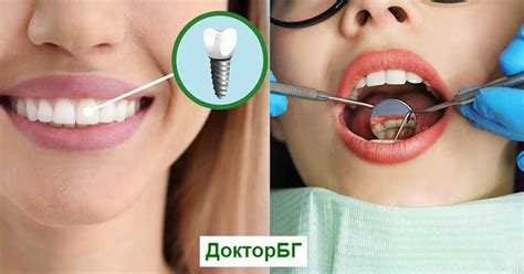 Зъбни импланти и естетична стоматология | ДокторБГ