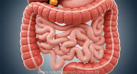O Que Causa Obstrução Intestinal - Obstrução Intestinal: Causas, Diagnóstico e Tratamentos | ResumeAI ...