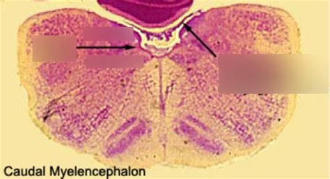 Development of the Myelencephalon Diagram | Quizlet