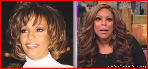 Wendy Williams Plastic Surgery - Celebrities Plastic Surgery