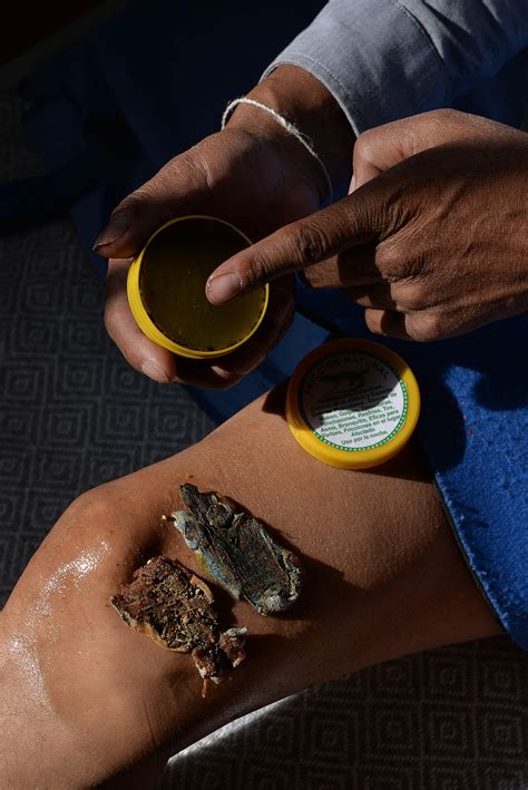 They rely on this lizard to heal their pain. Now it’s endangered