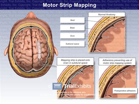 motor strip mapping