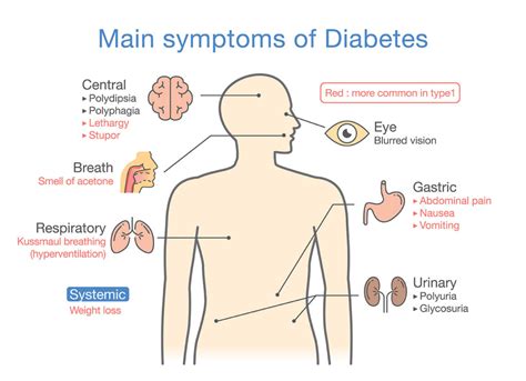 Signs & Symptoms of Type 1 or Type 2 Diabetes in Men & Women