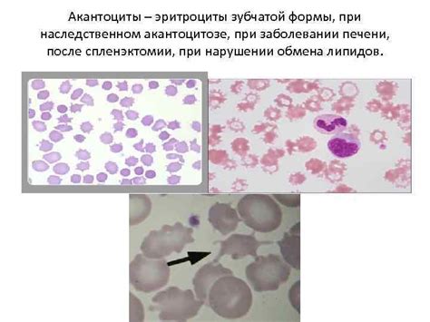 Гематология Лысова В А Гемопоэз Миелопоэз