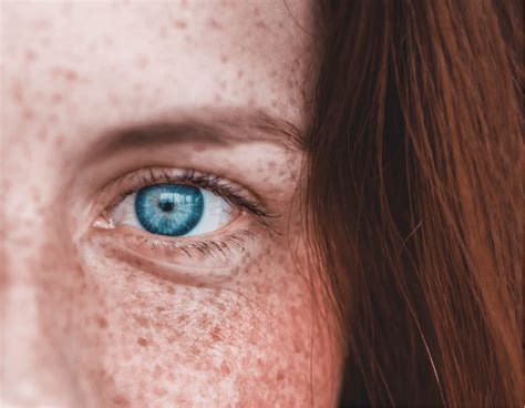 miopia operacion  es causas  sintomas visioon