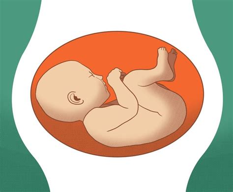 Bebê Na Posição Transversal Mexe Menos - O que significam as diferentes posições do bebê durante a gravidez