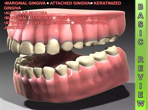 Gingival Recession | PPTX