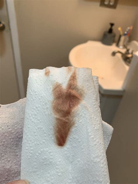 Light Pink Bleeding After Period