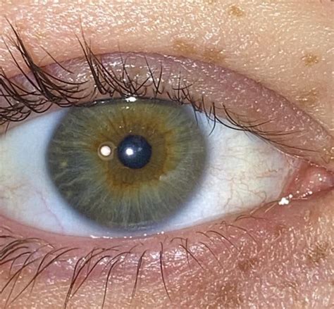 hazel, or central heterochromia? : r/eyes