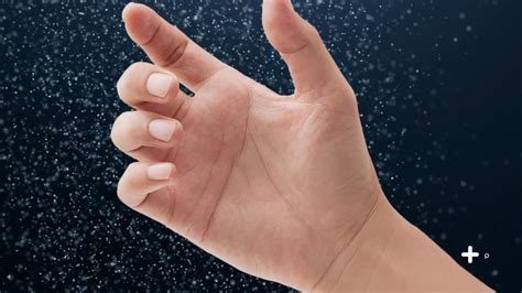carpal tunnel prevalence doctorpedia doctor reviewed video