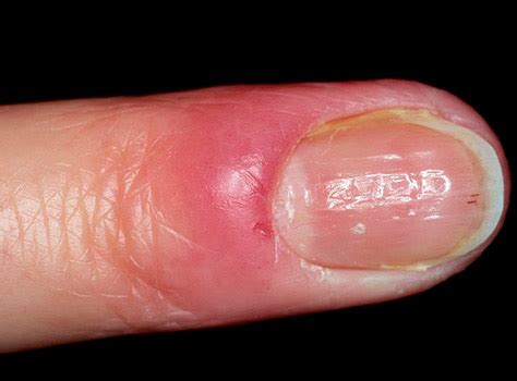Состояние ногтей – зеркало общего здоровья - Med36.com