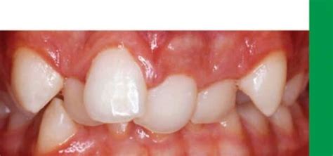 Basic Guide to Orthodontic Dental Nursing – PDF - GetUreBook