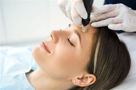 Dermapen skin needling treatment - Blossom Health