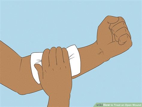 treat  open wound  steps  pictures wikihow