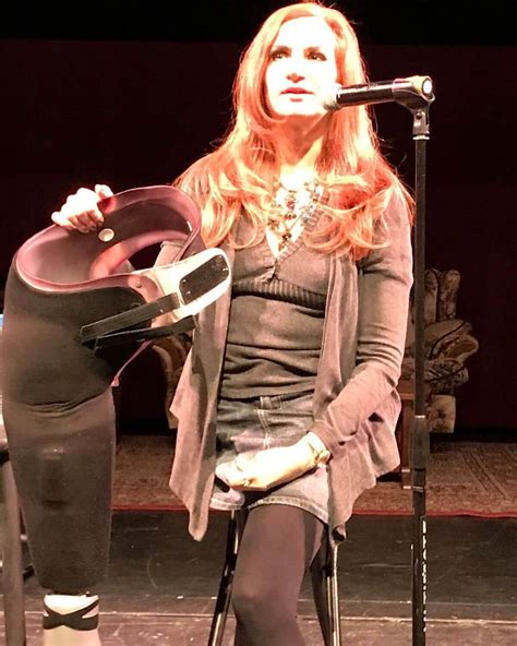 This Is What Losing A Leg Is Really Like Refinery29 Amputee Model Hot