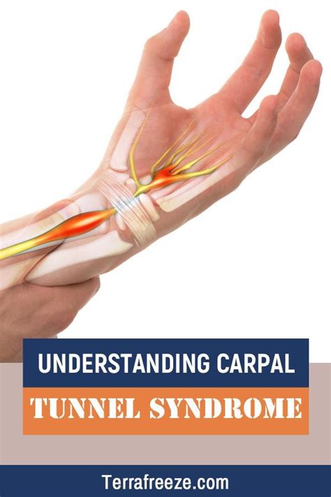 Carpal Tunnel Cream For Pain Relief | Anatomía