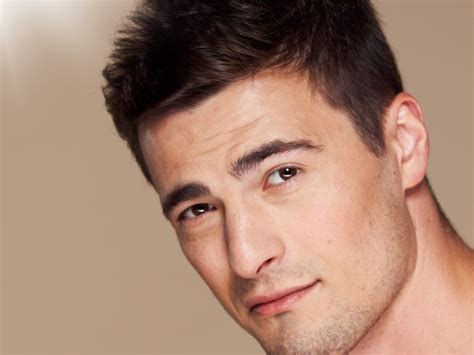 keravive scalp treatment  men springwell clinic