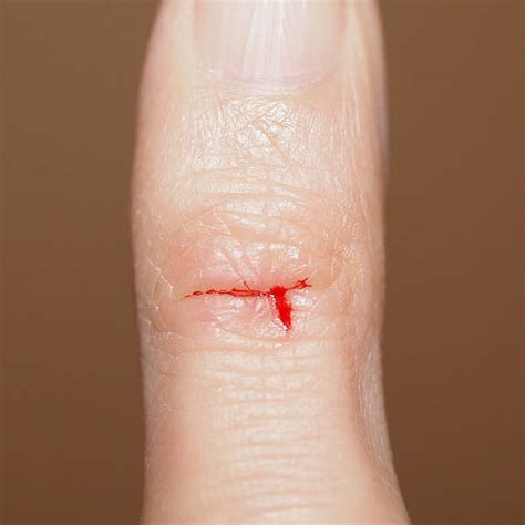Paper Cut Finger Stock Photos, Pictures & Royalty-Free Images - iStock