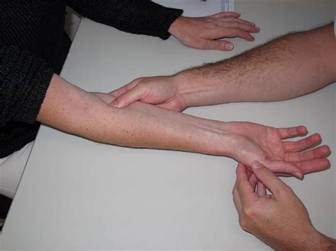 New Mini-invasive Decompression for Pronator Teres Syndrome - Journal ...