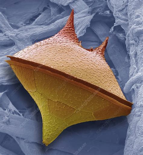 dinoflagellate sem stock image  science photo library
