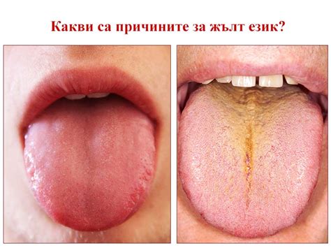 Сатурация – норма, ниски стойности | ArsMedica.bg