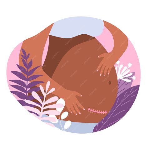 Free Vector | Hand drawn cesarean section