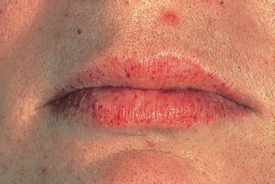 red spots  lips lipstutorialorg