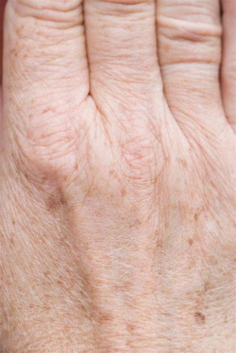 7 Caramel Skin Secrets Dermatologists Don't Want You To Know Image 5