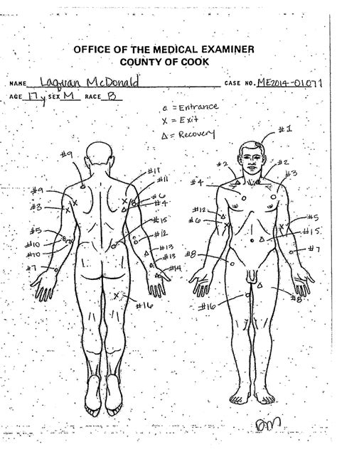 The Definitive Guide To The Laci Peterson Autopsy And Its Implications Image 11