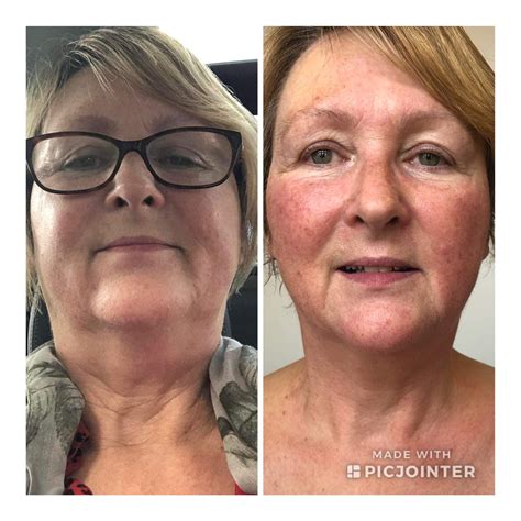 Physio Aesthetics - Kinetic Clinics