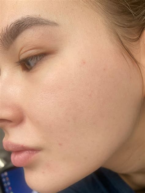 Лучшая сыворотка с витамином С - La Roche-Posay Pure Vitamin C 10 Anti ...