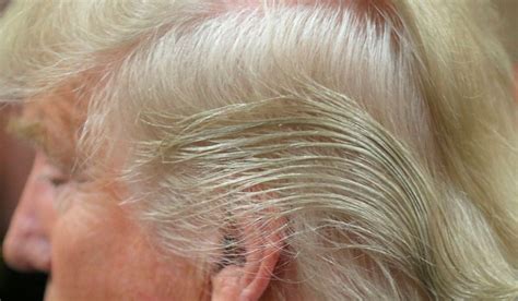 SIDE EFFECTS OF FINASTERIDE - DHI Panamá