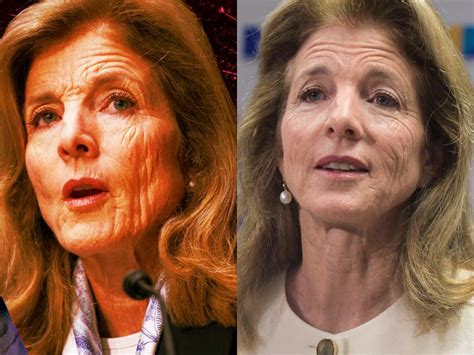 Caroline Kennedy Face Wrinkles: Health or Illness? Why Her Skin Looks Old