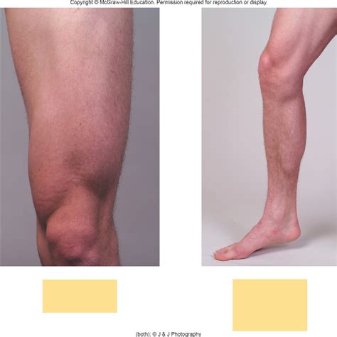 LEG MUSCLES Diagram | Quizlet