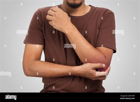 mans elbow swollen redness  accident stock photo alamy