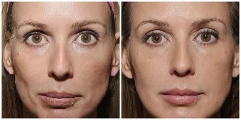 Rosealine Dawnxs' Secret? Amazing Before & Afters Revealed! Image 17