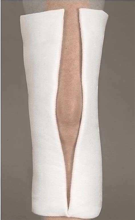 Posterior Knee Splint Kit - Knee Fracture Immobilizer Treatment | OrthoTape