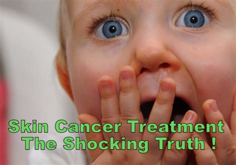 Skin Cancer Care Products – Article Reveals Shocking Truth On Skin ...