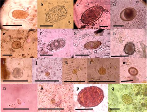 Parasitic stages found in dogs (a, c, d, e, f, g, h, i, k, m and n) and ...