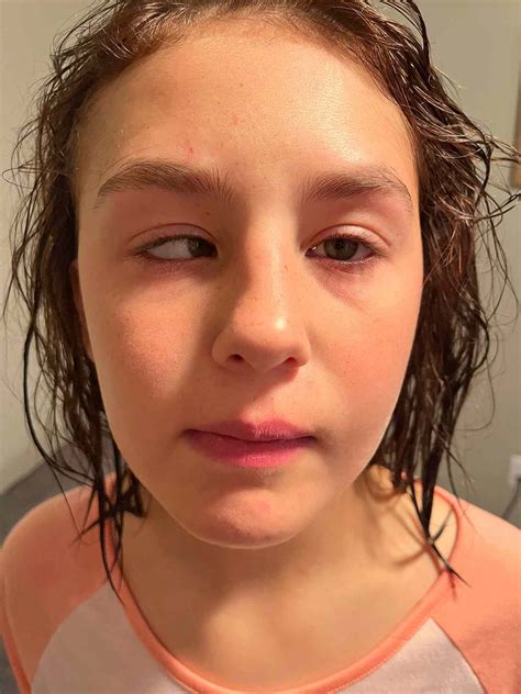 Meet the Teen Living with Céline Dion's Stiff-Person Syndrome