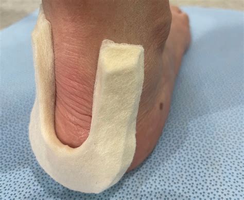 Best Women S Running Shoes For Haglund S Deformity at Margaret Cass blog