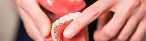 braces
