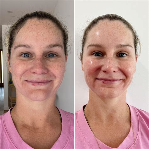 Thirsty Skin Plumping Sheet Mask – esmi