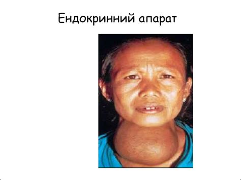 Ендокринний апарат - online presentation